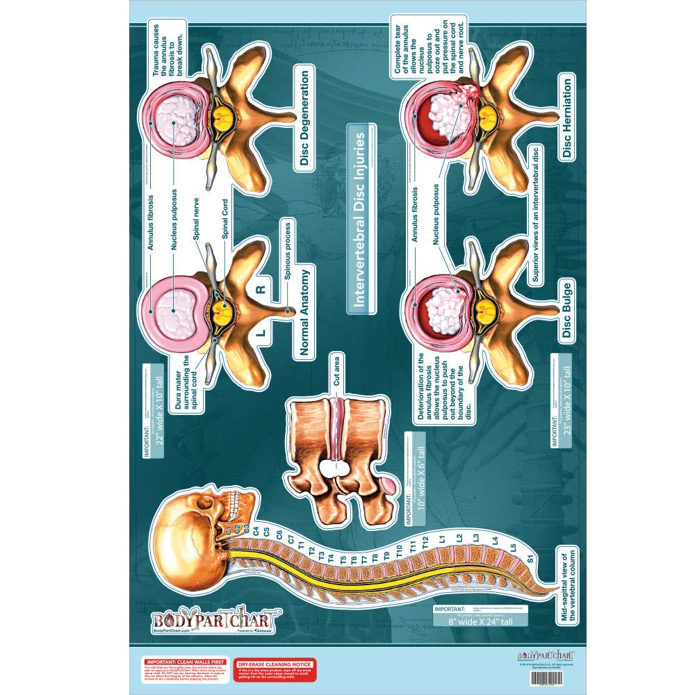 BodypartchartIntervertebalDiscInjuries
