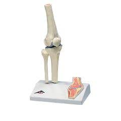 3bScientificAnatomicalModel-MiniKneeJointWithCrossSectionOfBoneOnBase-AnatomicalModel-MiniKneeJointWithCrossSectionOfBoneOnBase