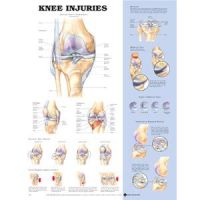 Knee Injury Chart 20 X 26 Styrene Plastic
