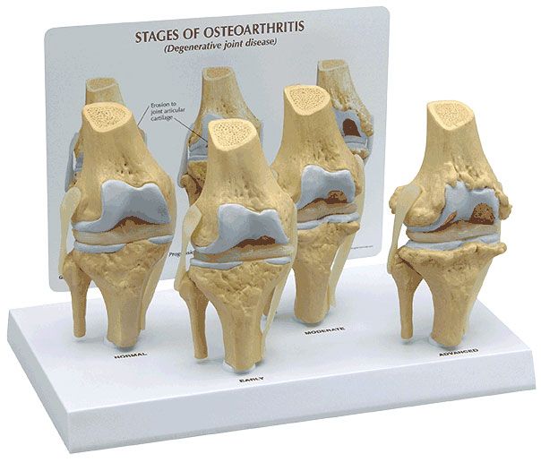 Four Stage Knee Model