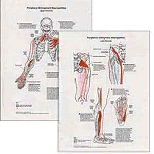PeripheralEntrapmentNeuropathics2ChartSet