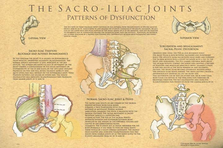 TheSacroiliacJoints:PatternsOfDysfunction