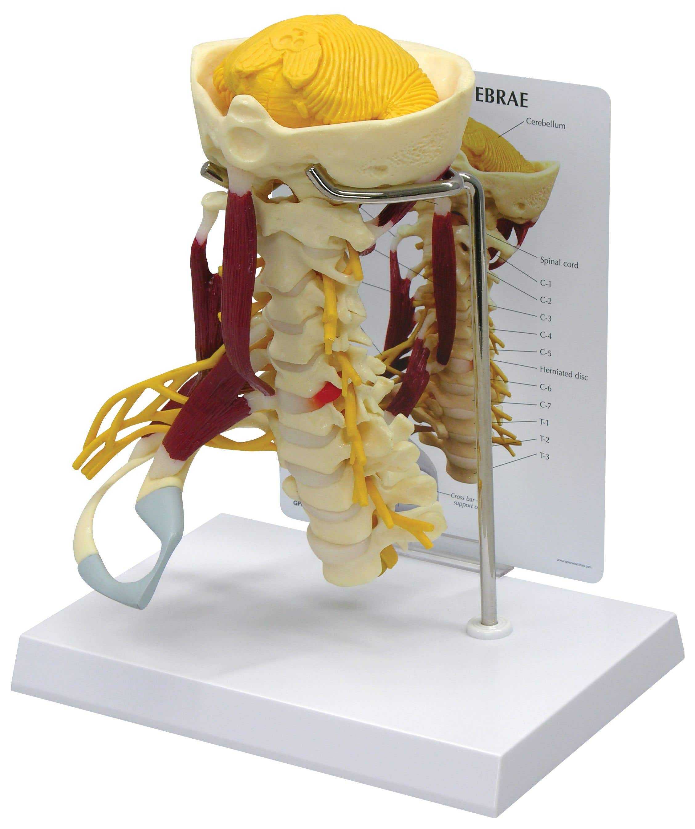 DeluxeMuscledCervical